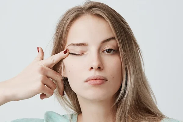 Eyelid Surgery (Blepharoplasty)